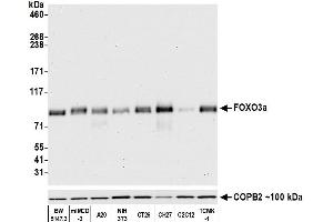Western Blotting (WB) image for anti-Forkhead Box O3 (FOXO3) (AA 450-500) antibody (ABIN7452580)