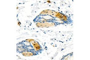 Immunohistochemistry of paraffin embedded mouse skin using CK13 (ABIN7074411) at dilution of 1:1200 (400x lens) (Cytokeratin 13 anticorps  (C-Term))