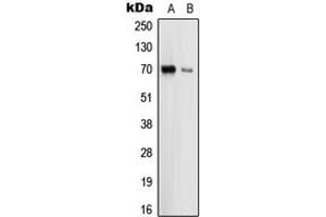 Western blot analysis of Uromodulin expression in HEK293T (A), THP1 (B) whole cell lysates. (Uromodulin anticorps  (Center))