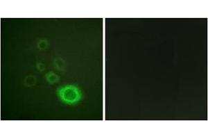 Immunofluorescence analysis of A549 cells, using c-Met (epitope around residue 1003) antibody. (c-MET anticorps  (Tyr1003))