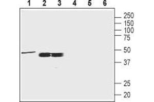 Western blot analysis of rat brain membrane (1:200), rat testis and mouse testis lysates (1:400): - 1-3.
