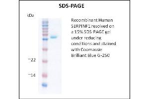 SDS-PAGE (SDS) image for serpin Peptidase Inhibitor, Clade F (Alpha-2 Antiplasmin, Pigment Epithelium Derived Factor), Member 1 (SERPINF1) (Active) protein (ABIN5509380) (PEDF Protéine)