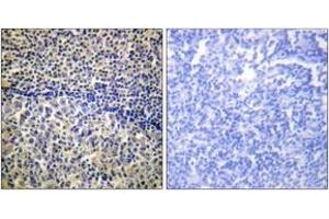 Immunohistochemistry analysis of paraffin-embedded human tonsil tissue, using p47 phox (Ab-328) Antibody. (NCF1 anticorps  (AA 301-350))