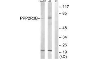 Western blot analysis of extracts from Jurkat/HuvEc cells, using PPP2R5D Antibody. (PPP2R5D anticorps  (AA 544-593))