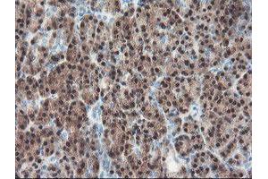 Immunohistochemical staining of paraffin-embedded Human pancreas tissue using anti-PGM3 mouse monoclonal antibody. (Phosphoglucomutase 3 anticorps)