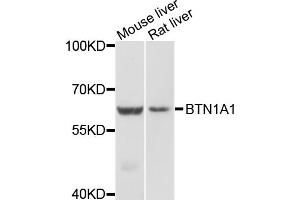 Western blot analysis of extracts of various cell lines, using BTN1A1 antibody (ABIN4903077) at 1:1000 dilution. (BTN1A1 anticorps)