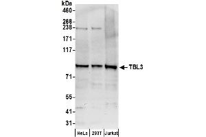 Western Blotting (WB) image for anti-Transducin (Beta)-Like 3 (TBL3) (AA 758-808) antibody (ABIN7449843)