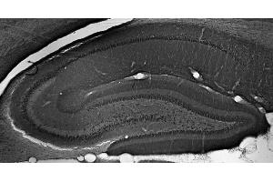Adult rat hippocampus immunohistochemistry.