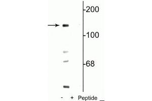 Western blot of mouse brain lysate showing specific immunolabeling of the ~140 kDa NR2C   subunit of the NMDA receptor phosphorylated at Ser1096 in the first lane (-). (GRIN2C anticorps  (pSer1096))
