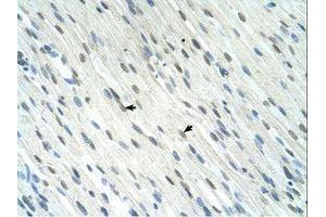 Image no. 1 for anti-SERTA Domain Containing 1 (SERTAD1) (N-Term) antibody (ABIN324352) (SERTAD1 anticorps  (N-Term))