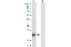 Western Blot analysis of TSC22D1 expression in transfected 293T cell line by TSC22D1 monoclonal antibody (M01), clone 1G7. (TSC22D1 anticorps  (AA 1-144))