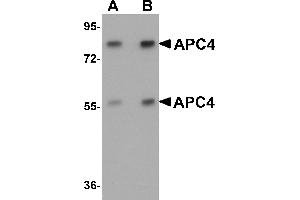 Western Blotting (WB) image for anti-Anaphase Promoting Complex Subunit 4 (ANAPC4) (N-Term) antibody (ABIN1031231) (ANAPC4 anticorps  (N-Term))