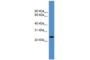 WB Suggested Anti-CD28 Antibody Titration: 0. (CD28 anticorps  (C-Term))