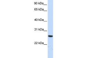 WB Suggested Anti-TTC33 Antibody Titration: 0. (TTC33 anticorps  (N-Term))