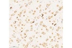 Immunohistochemistry analysis of paraffin-embedded rat brain using,RPL8 (ABIN7075442) at dilution of 1: 3000 (RPL8 anticorps)