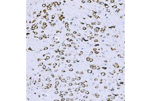 IHC analysis of VPRBP/DCAF1 using anti-VPRBP/DCAF1 antibody (ABIN7602005). (DDB1 and CUL4-Associated Factor 1 (DCAF1) (AA 540-861) anticorps)
