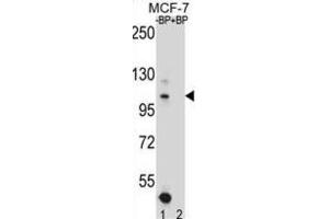 Western Blotting (WB) image for anti-Homeodomain Interacting Protein Kinase 1 (HIPK1) antibody (ABIN2996765)