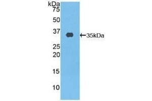 Detection of Recombinant ABCA3, Human using Polyclonal Antibody to ATP Binding Cassette Transporter A3 (ABCA3) (ABCA3 anticorps  (AA 1358-1635))