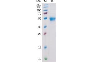 Human CD160 Protein, hFc Tag on SDS-PAGE under reducing condition.