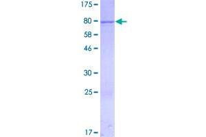 Image no. 1 for Interferon-Induced Protein with Tetratricopeptide Repeats 1 (IFIT1) (AA 1-478) protein (GST tag) (ABIN1307424)