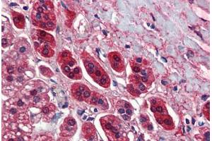 Human Adrenal (formalin-fixed, paraffin-embedded) stained with TCF21 antibody ABIN462190 followed by biotinylated goat anti-rabbit IgG secondary antibody ABIN481713, alkaline phosphatase-streptavidin and chromogen.