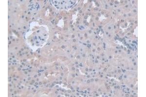 Detection of IFNg in Rat Kidney Tissue using Polyclonal Antibody to Interferon Gamma (IFNg) (Interferon gamma anticorps  (AA 23-156))