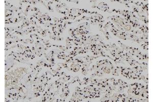 ABIN6266065 and ABIN6278212 at 1/100 staining Human lung tissue by IHC-P. (XPO4 anticorps  (N-Term))