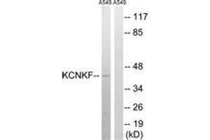 Western blot analysis of extracts from A549 cells, using KCNK15 Antibody. (KCNK15 anticorps  (AA 273-322))