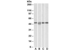 Western blot testing of Daudi [A], Jurkat [B], K562 [C] and MOLT4 [D] lysates with MAP2K2 antibody at 0. (MEK2 anticorps)