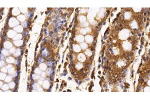 Detection of Surv in Porcine Colon Tissue using Monoclonal Antibody to Survivin (Surv)