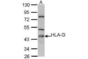 WB Image Sample (30 ug of whole cell lysate) A: Molt-4 , 10% SDS PAGE antibody diluted at 1:500 (HLAG anticorps)