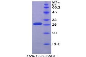 SDS-PAGE analysis of Mouse Sp100 Nuclear Antigen Protein.
