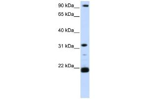 WB Suggested Anti-SNF8 Antibody Titration: 0. (SNF8 anticorps  (C-Term))
