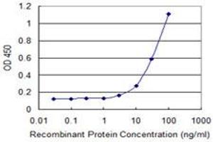 Detection limit for recombinant GST tagged PML is 1 ng/ml as a capture antibody. (PML anticorps  (AA 411-510))