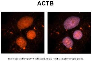 Sample Type: NT2 cells Red: Antibody Blue: DAPI Primary Dilution: 1ug/50ul antibody Secondary Antibody: Alexa goat anti-rabbit 594 Image Submitted by: Yuzhi Chen, University of Arkansas for Medical Sciences (beta Actin anticorps  (Middle Region))
