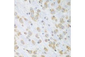 Immunohistochemistry of paraffin-embedded mouse brain using PDIA3 antibody.