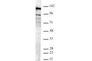 JMJD2B / KDM4B antibody (rAb) tested by Western blot. (Recombinant KDM4B anticorps)