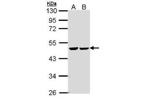 WB Image Sample (30 ug of whole cell lysate) A: 293T B: A431 , 10% SDS PAGE antibody diluted at 1:5000 (FH anticorps)
