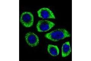 Confocal immunofluorescent analysis of PIP5KL1 Antibody (N-term) Cat.