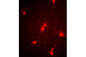 Immunofluorescence image of cultured chick retinal amacrine (neuronal) cells labeled with CLCN4 polyclonal antibody . (CLCN4 anticorps  (C-Term))