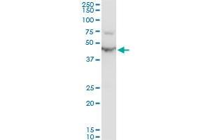 ENO1 polyclonal antibody (A01), Lot # SFU4050831QCS1.