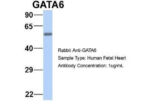 Host:  Rabbit  Target Name:  GATA6  Sample Type:  Human Fetal Heart  Antibody Dilution:  1. (GATA6 anticorps  (N-Term))
