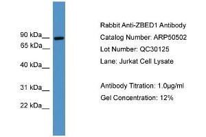 WB Suggested Anti-ZBED1  Antibody Titration: 0. (ZBED1 anticorps  (C-Term))