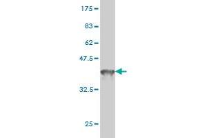 Western Blot detection against Immunogen (36. (DDX41 anticorps  (AA 523-622))