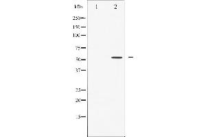 Western blot analysis of Caspase 8 phosphorylation expression in Jurkat whole cell lysates,The lane on the left is treated with the antigen-specific peptide.