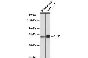 Western blot analysis of extracts of various cell lines, using CLN5 antibody (ABIN6133293, ABIN6138735, ABIN6138736 and ABIN6216682) at 1:3000 dilution. (CLN5 anticorps  (AA 96-407))