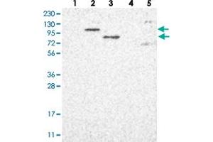 Western blot analysis of Lane 1: RT-4, Lane 2: U-251 MG, Lane 3: Human Plasma, Lane 4: Liver, Lane 5: Tonsil with PARP10 polyclonal antibody  at 1:250-1:500 dilution.