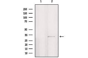 Western blot analysis of extracts from HepG2, using PPP1R3D Antibody. (PPP1R3D anticorps  (Internal Region))