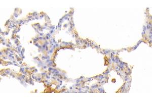Detection of JAK3 in Human Lung Tissue using Polyclonal Antibody to Janus Kinase 3 (JAK3) (JAK3 anticorps  (AA 716-967))