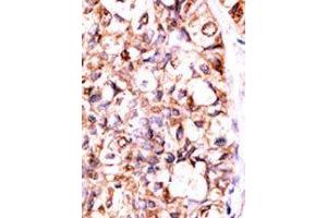 Image no. 2 for anti-Protein Phosphatase 5, Catalytic Subunit (PPP5C) (C-Term) antibody (ABIN360837) (PP5 anticorps  (C-Term))